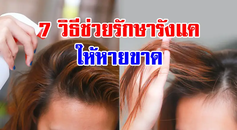 7 วิธีช่วยขจัด 